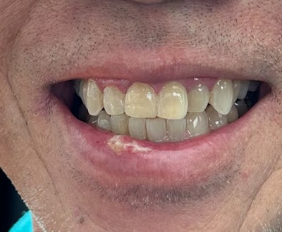 Beaumont Smiles Dental | Plastic Surgeon in Beaumont | ProSculptMD.com