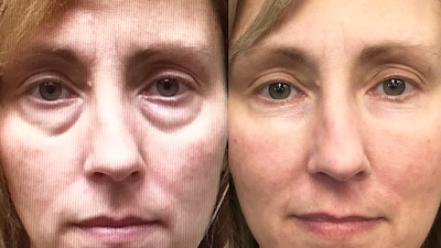 Form Medical Aesthetics | Plastic Surgeon in WinnipegProSculptMD.ca