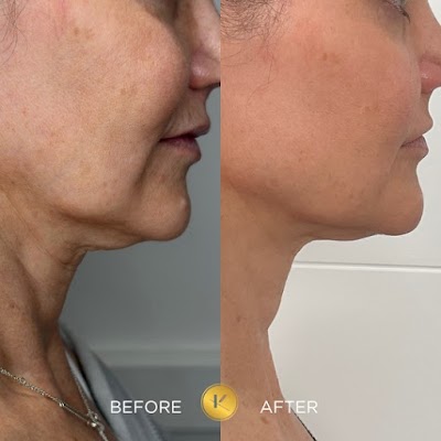 Kane Medical Aesthetics | Plastic Surgeon in Calgary | ProSculptMD.com