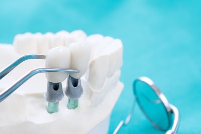Mills Haven Dental | Plastic Surgeon in Sherwood Park | ProSculptMD.com