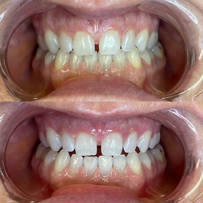 Newave Aesthetic Studio | Plastic Surgeon in SteinbachProSculptMD.ca