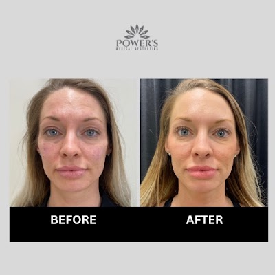 Power's Medical Aesthetics Inc | Plastic Surgeon in Spruce Grove | ProSculptMD.com