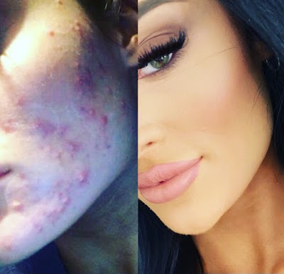 Rockyview Medical Aesthetics | Plastic Surgeon in Calgary | ProSculptMD.com