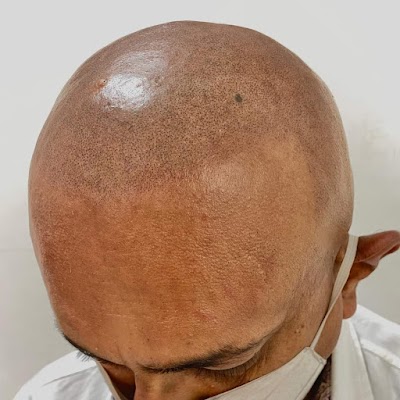 The Transformation Clinic | Plastic Surgeon in Grande Prairie | ProSculptMD.com