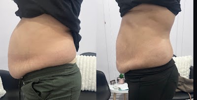 True Curves Body contouring and Medical Spa | Plastic Surgeon in WinnipegProSculptMD.ca